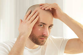 10 Reasons for Hair Loss