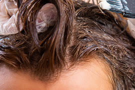 Dying your hair after a hair transplant... Is it possible?