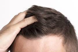 What is folliculitis, and how to treat it