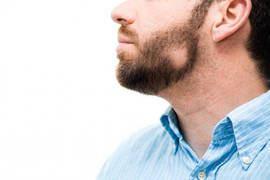What causes autoimmune hair loss? Is there a treatment?