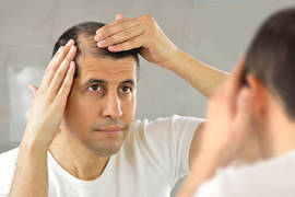 Caída estacional del cabello: ¿cuándo y por qué se produce?