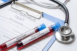 Are coronavirus and alopecia related each other?