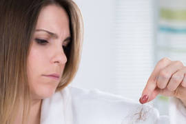Frontal fibrosing alopecia: what is it and how to cure it