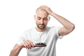 Is it possible to transplant hair from another person?