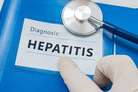 Can I get a hair transplant having Hepatitis C?