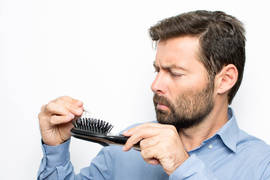 How to know if you are becoming bald, and how to prevent it
