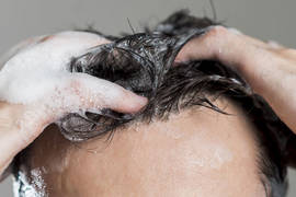 Cómo lavar el pelo después de un trasplante capilar