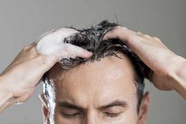 When and how to wash your hair after a hair transplant