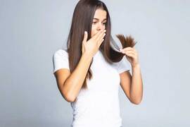Alopecia hormonal: qué es y cómo tratarla