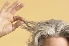 How many hairs fall out a day? How much falling is too much?