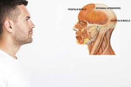 Epicranial aponeurosis (galea aponeurotica) and hair loss
