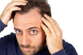 Hair transplant: Questions and answers