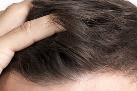 Hair Transplant Turkey 2024: Your Guide to the Best Clinics and Surgeons