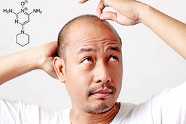 Minoxidil and hair loss: what are its side effects?