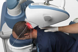 Robotic hair transplant: all the truth