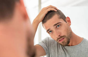 Diffus alopeci: orsaker och behandling