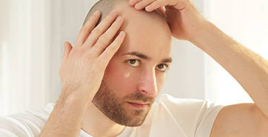 10 Reasons for Hair Loss