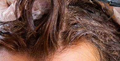 Dying your hair after a hair transplant... Is it possible?