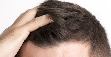What is folliculitis, and how to treat it