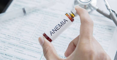 Anemia and hair loss: causes and solutions