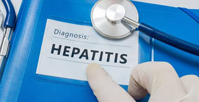 Can I get a hair transplant having Hepatitis C?