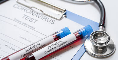 ¿Soy más propenso al coronavirus si tengo alopecia?