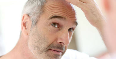 ¿Es viable un trasplante capilar con canas?
