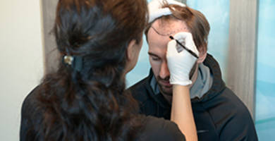 تكلفة زراعة الشعر في تركيا