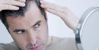 Hair falling after hair transplant operation