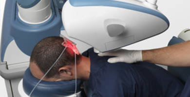 Robotic hair transplant: all the truth