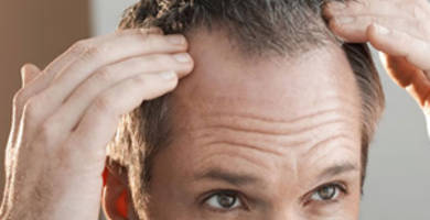 Crown hair transplant: growth time and results