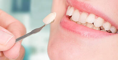 Porcelain Lamina Veneer