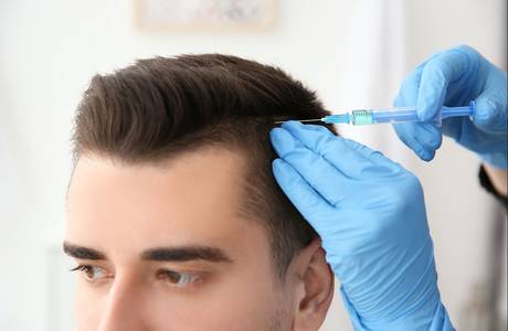 Trianguläre Alopezie