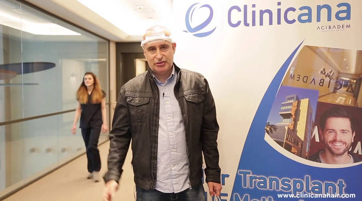 operación de implante de cabello de Miguel