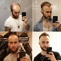 Before and After