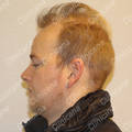 Vorher