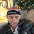 After hair transplant