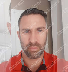 After hair transplant After hair transplant