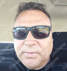 After hair transplant After hair transplant
