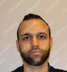 Before hair transplant Before hair transplant