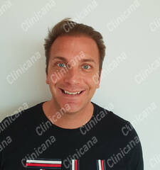 After hair transplant After hair transplant