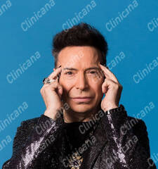 After hair transplant After hair transplant