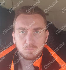 After hair transplant After hair transplant