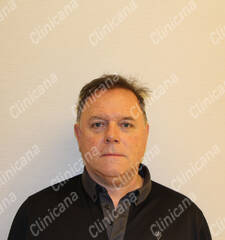 After hair transplant After hair transplant