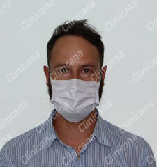 After hair transplant After hair transplant